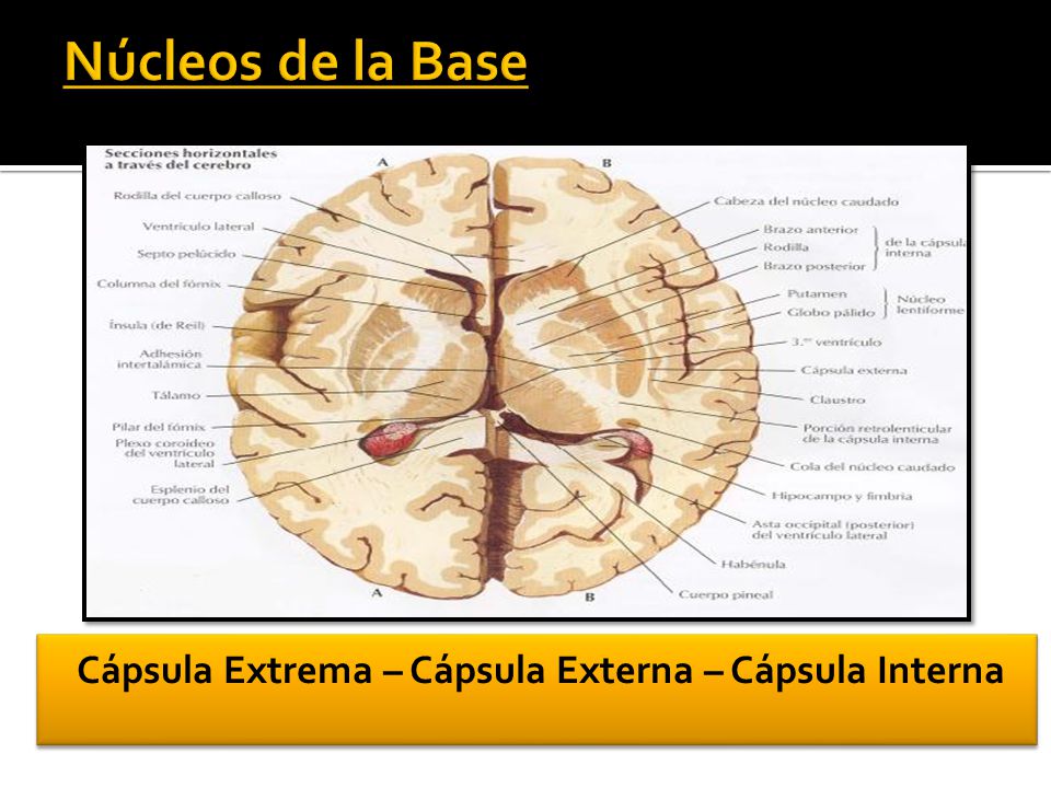Cerebro izquierdo cápsula interna